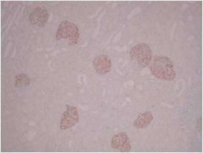 Immunocytochemistry: PLA2R1 Antibody (12-6-5) - Azide and BSA Free [NBP2-80912]