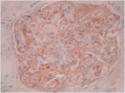 Immunohistochemistry: PLA2R1 Antibody (12-6-5) - Azide and BSA Free [NBP2-80912]