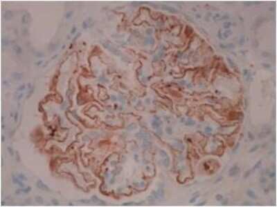 Immunohistochemistry: PLA2R1 Antibody (12-6-5) - BSA Free [NBP2-50248]