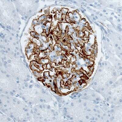 Immunohistochemistry-Paraffin: PLA2R1 Antibody (CL0474) [NBP2-52933]