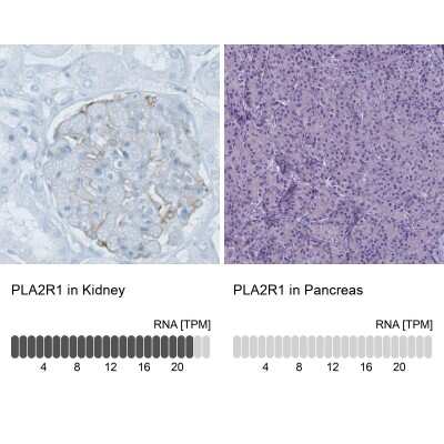 Immunohistochemistry-Paraffin: PLA2R1 Antibody (CL0474) [NBP2-52933]