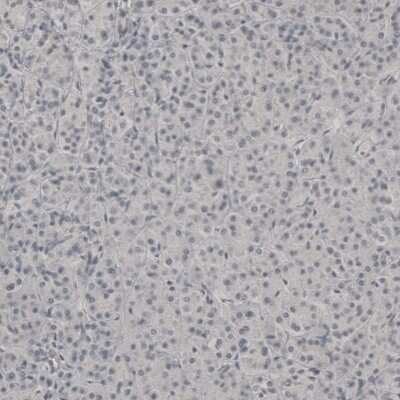 Immunohistochemistry-Paraffin: PLA2R1 Antibody [NBP1-84449]