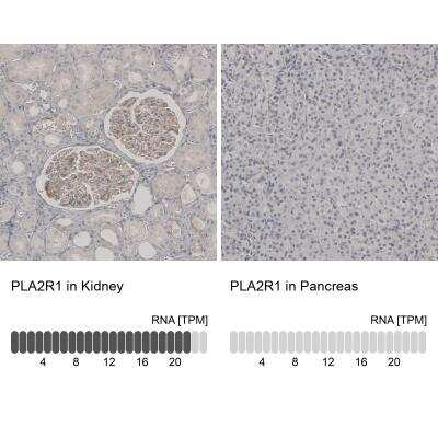 Immunohistochemistry-Paraffin: PLA2R1 Antibody [NBP1-84449]