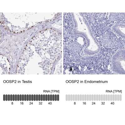 Immunohistochemistry-Paraffin: PLAC1L Antibody [NBP2-33601]