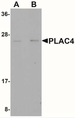 Western Blot: PLAC4 AntibodyBSA Free [NBP2-41125]