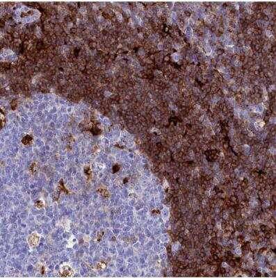 Immunohistochemistry-Paraffin: PLAC8 Antibody [NBP1-90721]