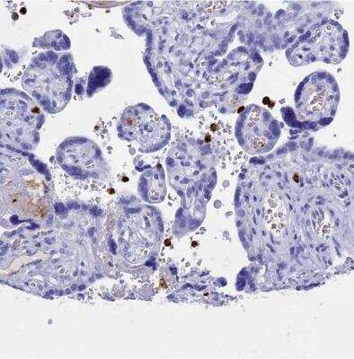 Immunohistochemistry-Paraffin: PLAC8 Antibody [NBP1-90721]