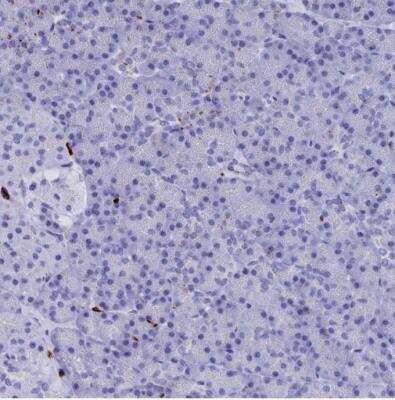 Immunohistochemistry-Paraffin: PLAC8 Antibody [NBP1-90721]