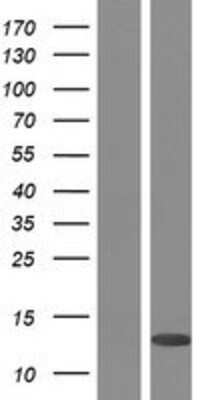 Western Blot: PLAC8 Overexpression Lysate [NBP2-09521]