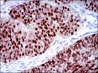 Immunohistochemistry-Paraffin: PLAGL1 Antibody (8D8C5) - BSA Free [NBP2-37343]