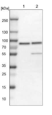 Western Blot: PLAP Antibody [NBP1-84996]