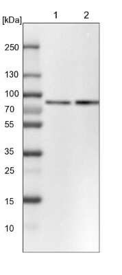 Western Blot: PLAP Antibody [NBP1-84997]