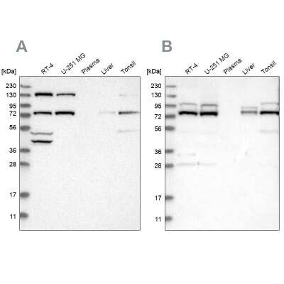 Western Blot: PLAP Antibody [NBP1-84997]