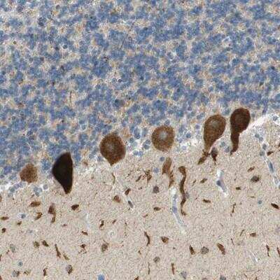 Immunohistochemistry-Paraffin: PLBD2 Antibody [NBP1-90681]
