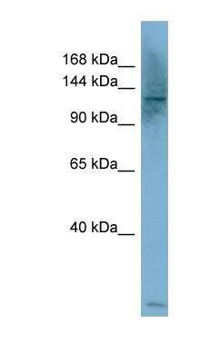 Western Blot: PLC-beta 1 Antibody [NBP1-58257]