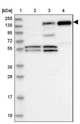 Western Blot: PLC-beta 1 Antibody [NBP2-38220]