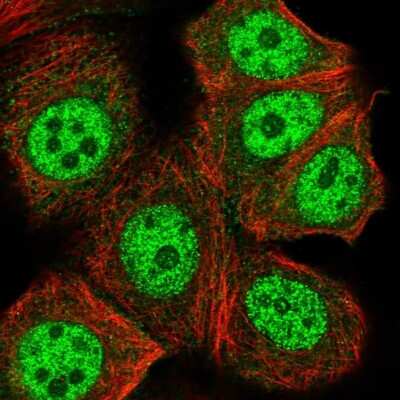 Immunocytochemistry/ Immunofluorescence: PLC-beta 3 Antibody [NBP2-31974]