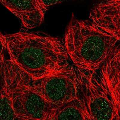 Immunocytochemistry/ Immunofluorescence: PLC-beta 3 Antibody [NBP2-32026]