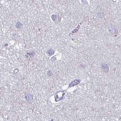 Immunohistochemistry-Paraffin: PLC-beta 3 Antibody [NBP2-32026]