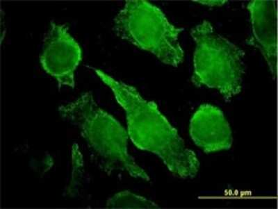Immunocytochemistry/ Immunofluorescence: PLC-gamma 1 Antibody (2A2) [H00005335-M01]