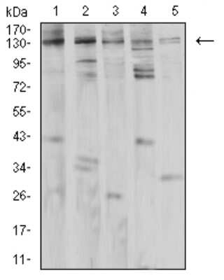 Western Blot: PLC-gamma 1 Antibody (2F3D11)BSA Free [NBP2-61790]