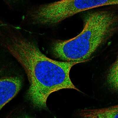 Immunocytochemistry/ Immunofluorescence: PLC-gamma 1 Antibody [NBP2-38317]