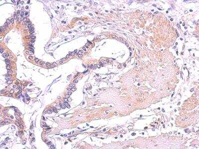 Immunohistochemistry-Paraffin: PLC-gamma 2 Antibody [NBP1-33036]