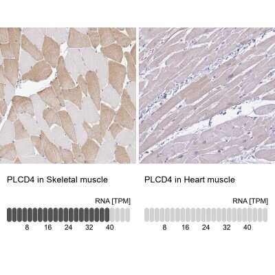 Immunohistochemistry-Paraffin: PLCD4 Antibody [NBP2-38392]