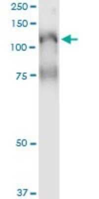 Immunoprecipitation: PLCL2 Antibody (1C7) [H00023228-M02]
