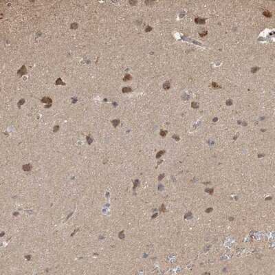 Immunohistochemistry-Paraffin: PLCL3 Antibody [NBP1-88009]