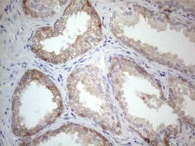 Immunohistochemistry: PLCXD1 Antibody (OTI2D7) [NBP2-46442]