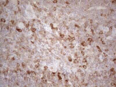 Immunohistochemistry: PLCXD1 Antibody (OTI2D7) [NBP2-46442]
