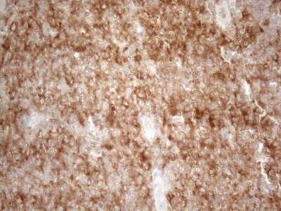 Immunohistochemistry: PLCXD1 Antibody (OTI2D7) [NBP2-46442]
