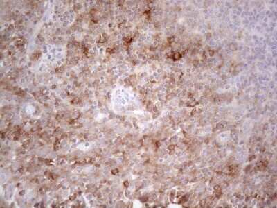 Immunohistochemistry: PLCXD1 Antibody (OTI2D7) [NBP2-46442]