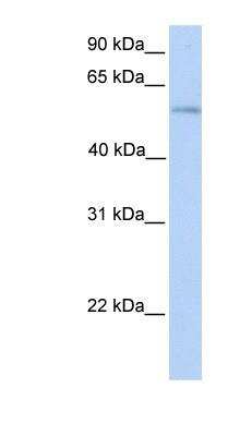 Western Blot: PLD3/Phospholipase D3 Antibody [NBP1-59921]
