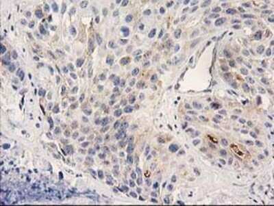 Immunohistochemistry: PLEKHA3 Antibody (OTI5D11) - Azide and BSA Free [NBP2-73470]