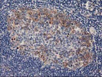 Immunohistochemistry: PLEKHA3 Antibody (OTI5D11) - Azide and BSA Free [NBP2-73470]