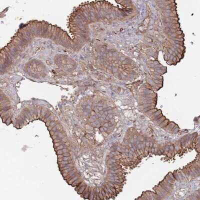 Immunohistochemistry-Paraffin: PLEKHA4 Antibody [NBP2-47331]
