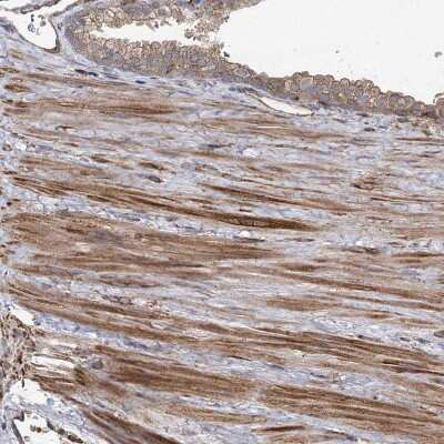 Immunohistochemistry-Paraffin: PLEKHA7 Antibody [NBP1-85045]