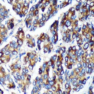 Immunohistochemistry-Paraffin: PLEKHB2 Antibody - Azide and BSA Free [NBP2-94817]