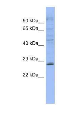 Western Blot: PLEKHB2 Antibody [NBP1-56835]