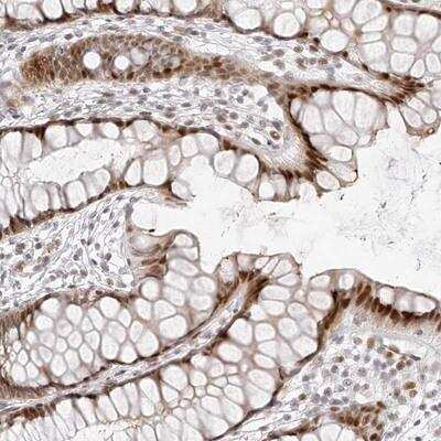 Immunohistochemistry-Paraffin: PLEKHG1 Antibody [NBP1-90846]