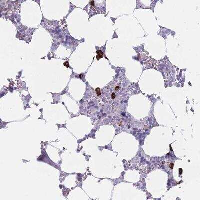 Immunohistochemistry-Paraffin: PLEKHG2 Antibody [NBP2-13773]