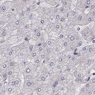 Immunohistochemistry-Paraffin: PLEKHG3 Antibody [NBP2-68986]