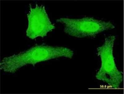 Immunocytochemistry/ Immunofluorescence: PLEKHG5 Antibody (5A9) [H00057449-M01]