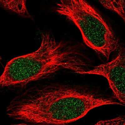Immunocytochemistry/ Immunofluorescence: PLEKHG5 Antibody [NBP2-13774]
