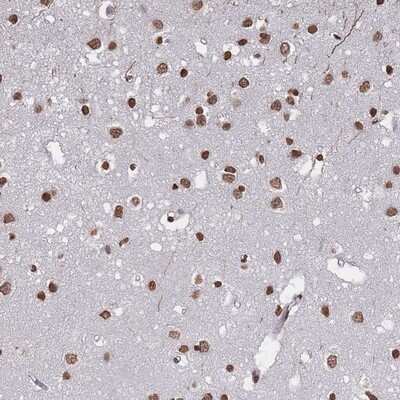 Immunohistochemistry-Paraffin: PLEKHG5 Antibody [NBP2-13774]
