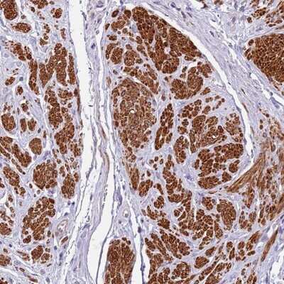 Immunohistochemistry-Paraffin: PLEKHH1 Antibody [NBP2-14611]