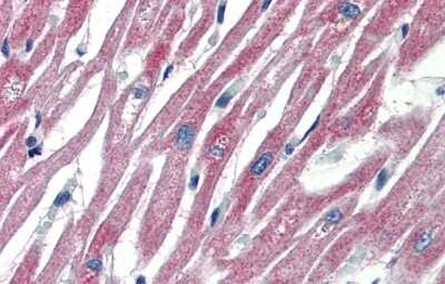 Immunohistochemistry-Paraffin: PLEKHH2 Antibody [NBP1-70677]