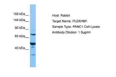 Western Blot: PLEKHM1 Antibody [NBP2-88068]
